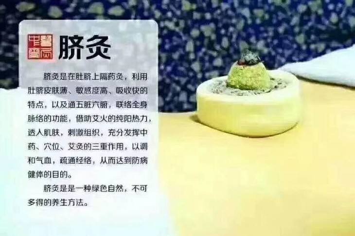 济南艾灸督灸脐灸养生班